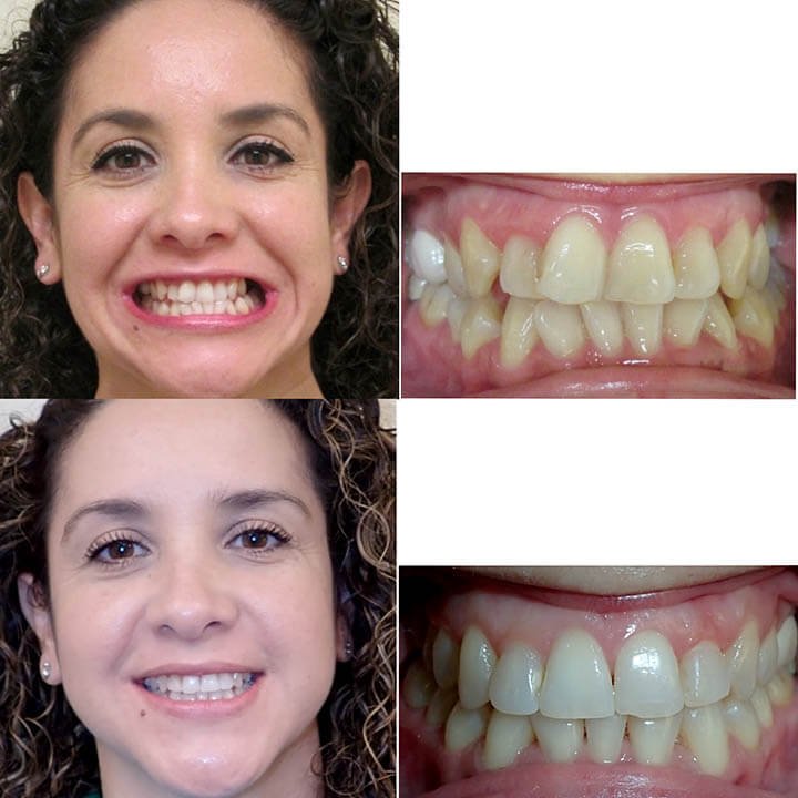 Before-after-dental-trainer-results-reviews