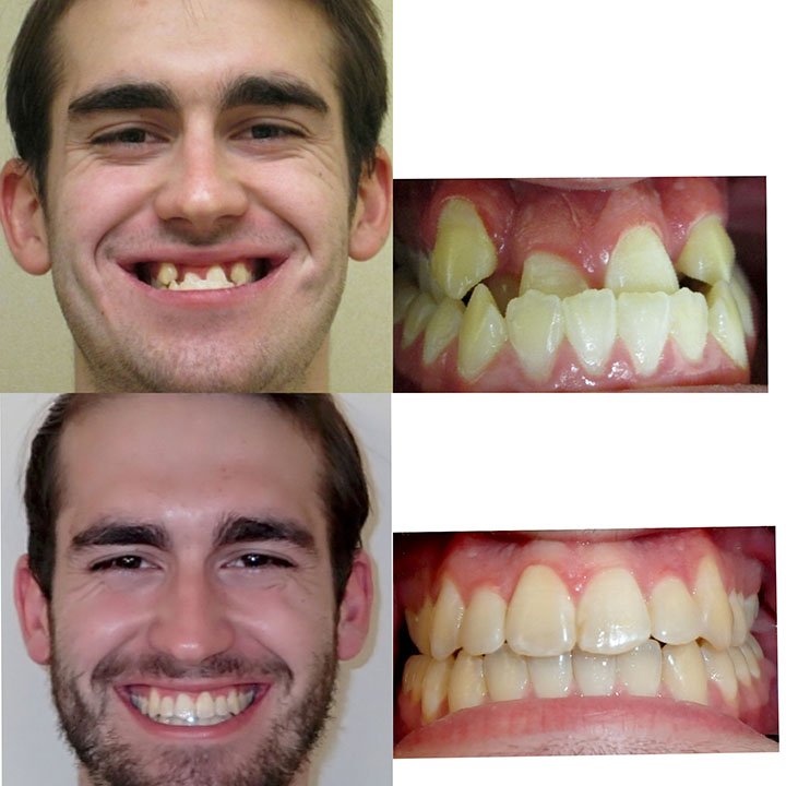 Before-after-dental-trainer-results-reviews