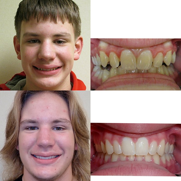 Before-after-dental-trainer-results-reviews