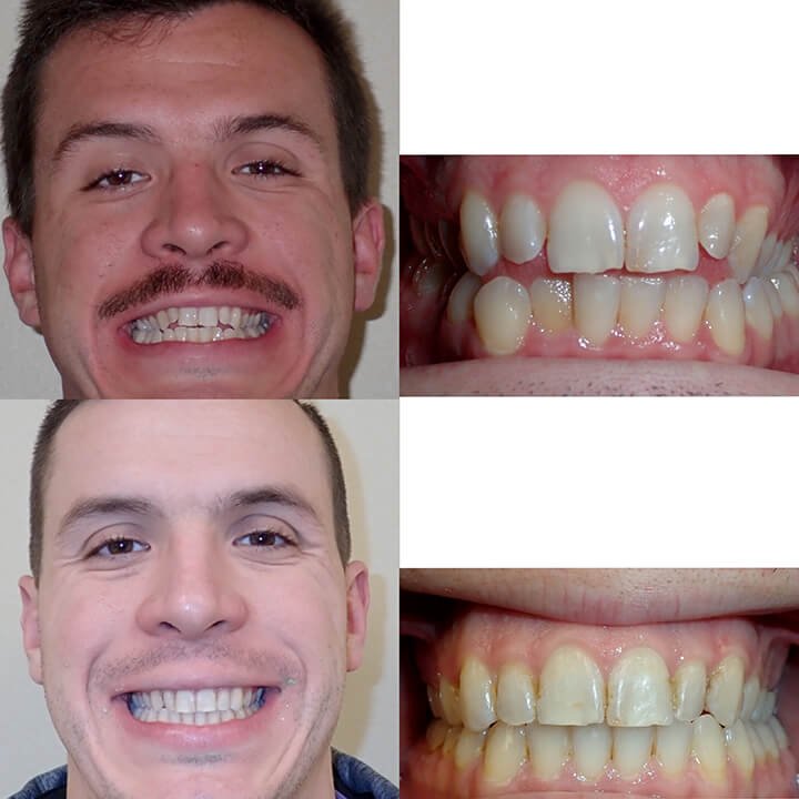 Before-after-dental-trainer-results-reviews