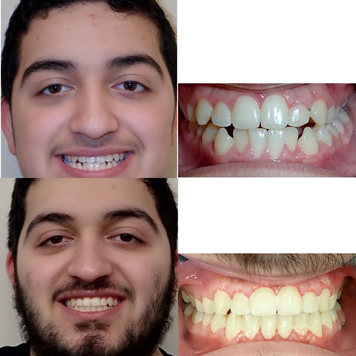 Before-after-dental-trainer-results-reviews