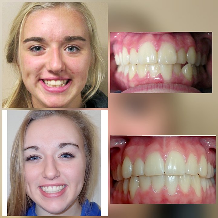 Before-after-dental-trainer-results-reviews