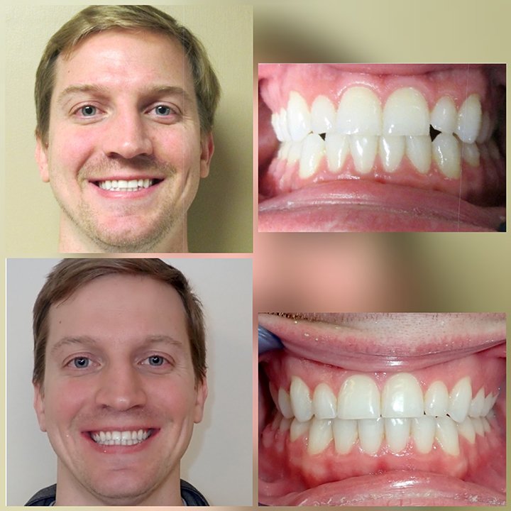 Before-after-dental-trainer-results-reviews